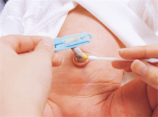 新生儿什么时候剪脐带最好