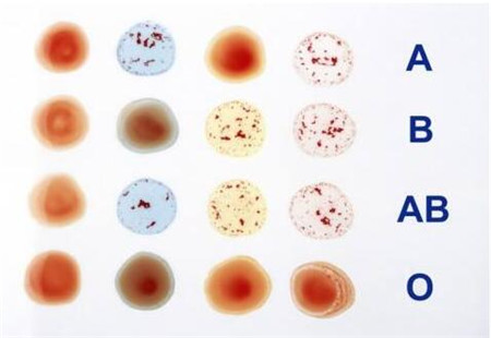 rh阳性是什么意思