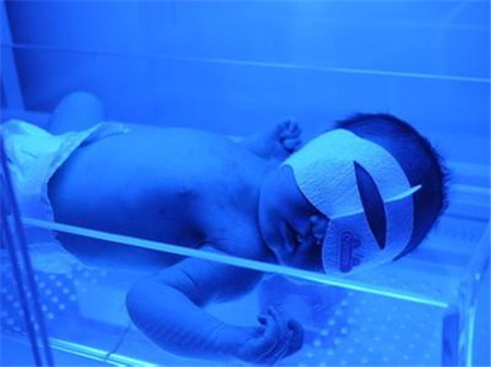 新生儿黄疸照蓝光要照几天