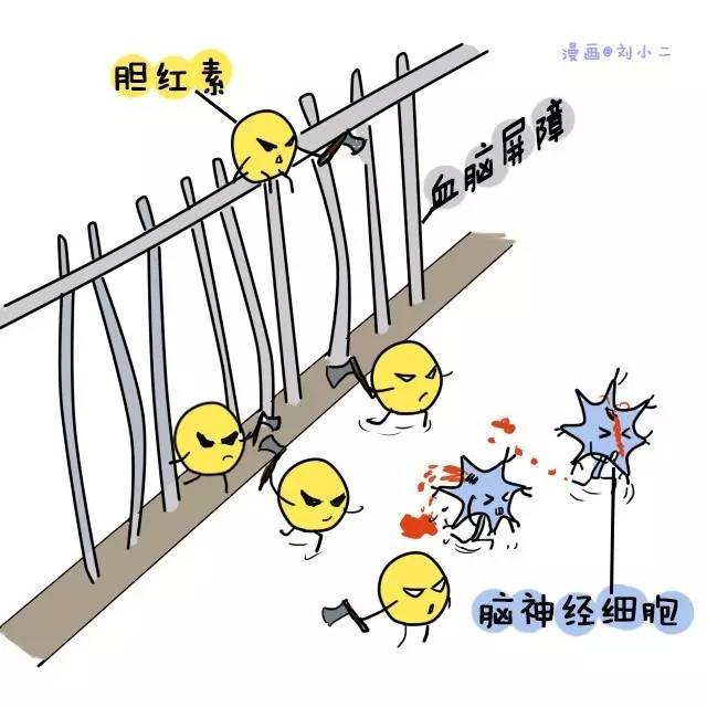 ▼胆红素会通过血脑屏障,损伤神经系统,造成胆红素脑病(核黄疸),导致