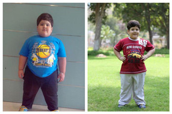 印度4岁胖仔切七成胃 顺利瘦身40斤