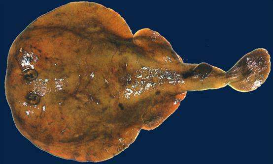 电鳐和电鳗的故事