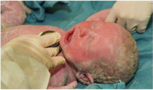 大部分宝宝刚出生时,头型都怪怪的,这是因为宝宝的骨骼系统,尤其是