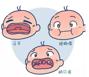 需要给新生宝宝清洗口腔吗新生宝宝每天口腔都要清理吗2018